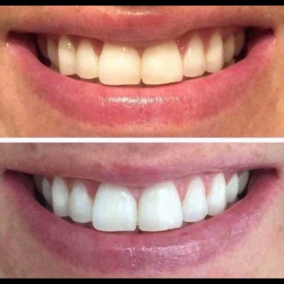 THE BEST Whitening Toothpaste!  NO HARSH CHEMICALS - Picture 5 of 12